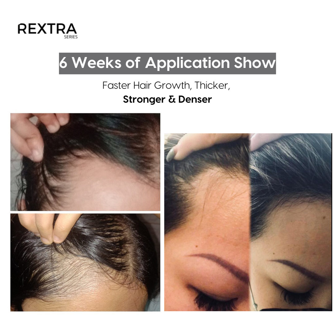 The Ultimate Hair Growth Elixir by Rextra Series | Clinically Proven Anti-Hair Fall Serum